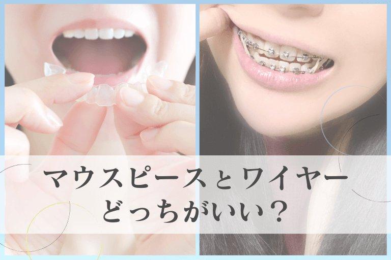 マウスピース矯正とは？ワイヤー矯正との違い