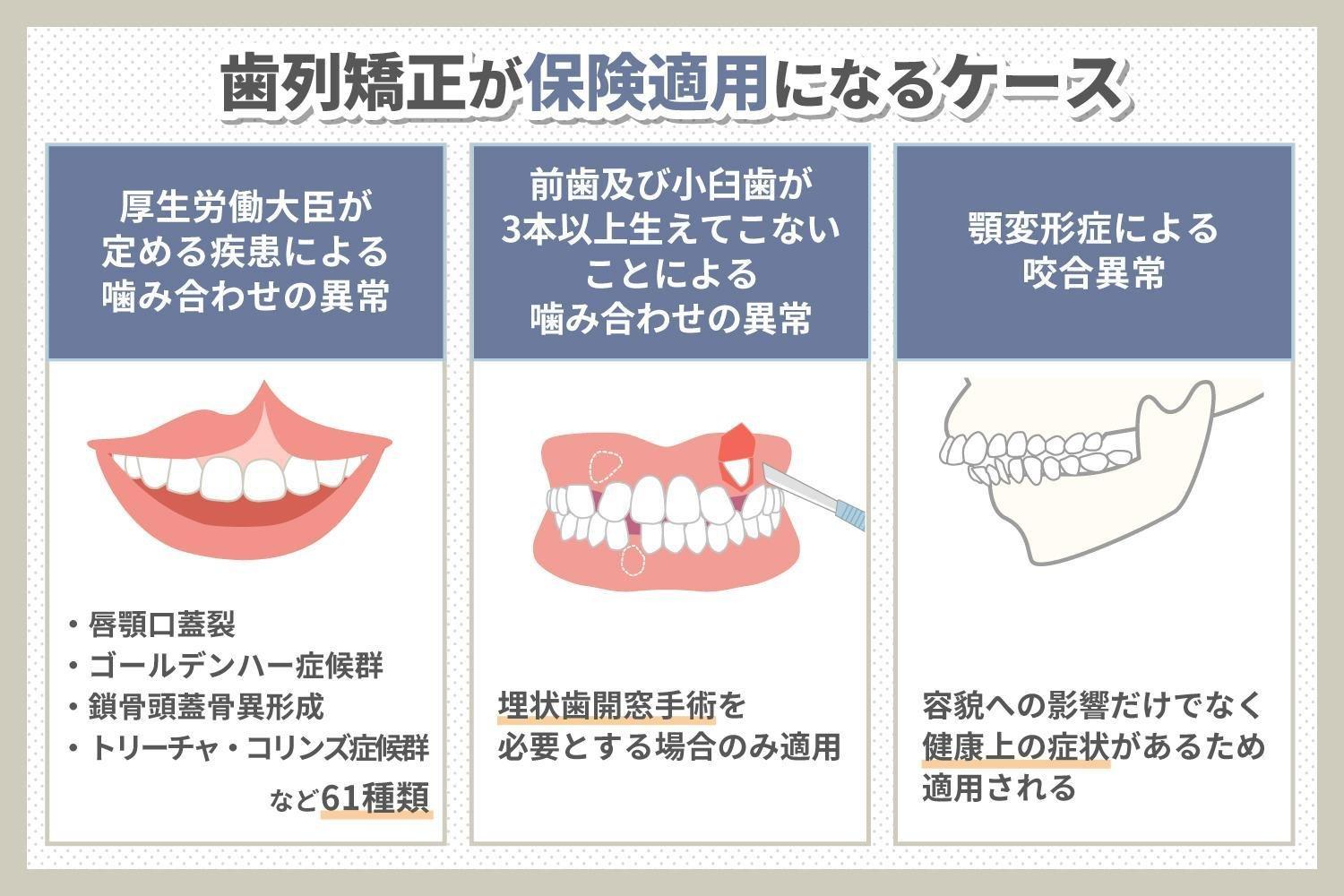 保険適用される矯正治療の3つの前提条件