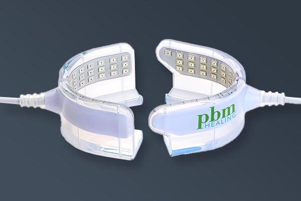 矯正装置の種類別に見る料金の目安