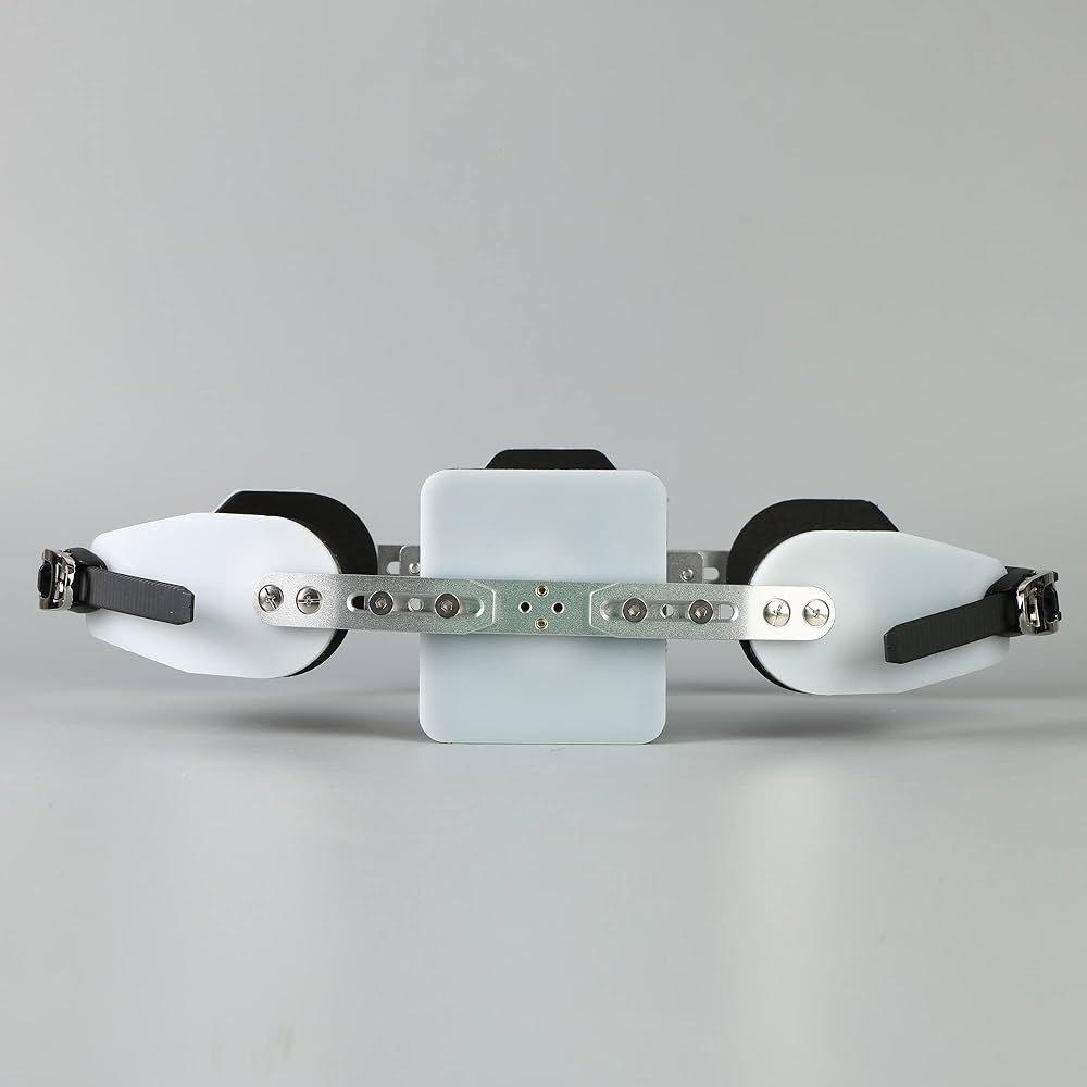 矯正のコスパで損しないためのチェックリスト