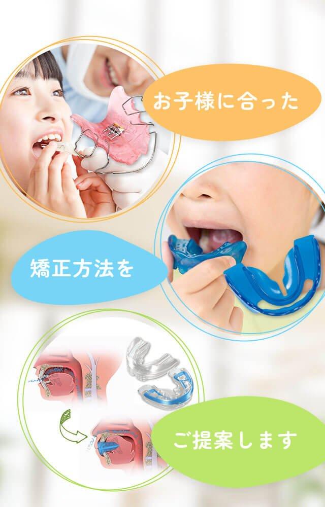 子どもの過蓋咬合に気づいたときの対応