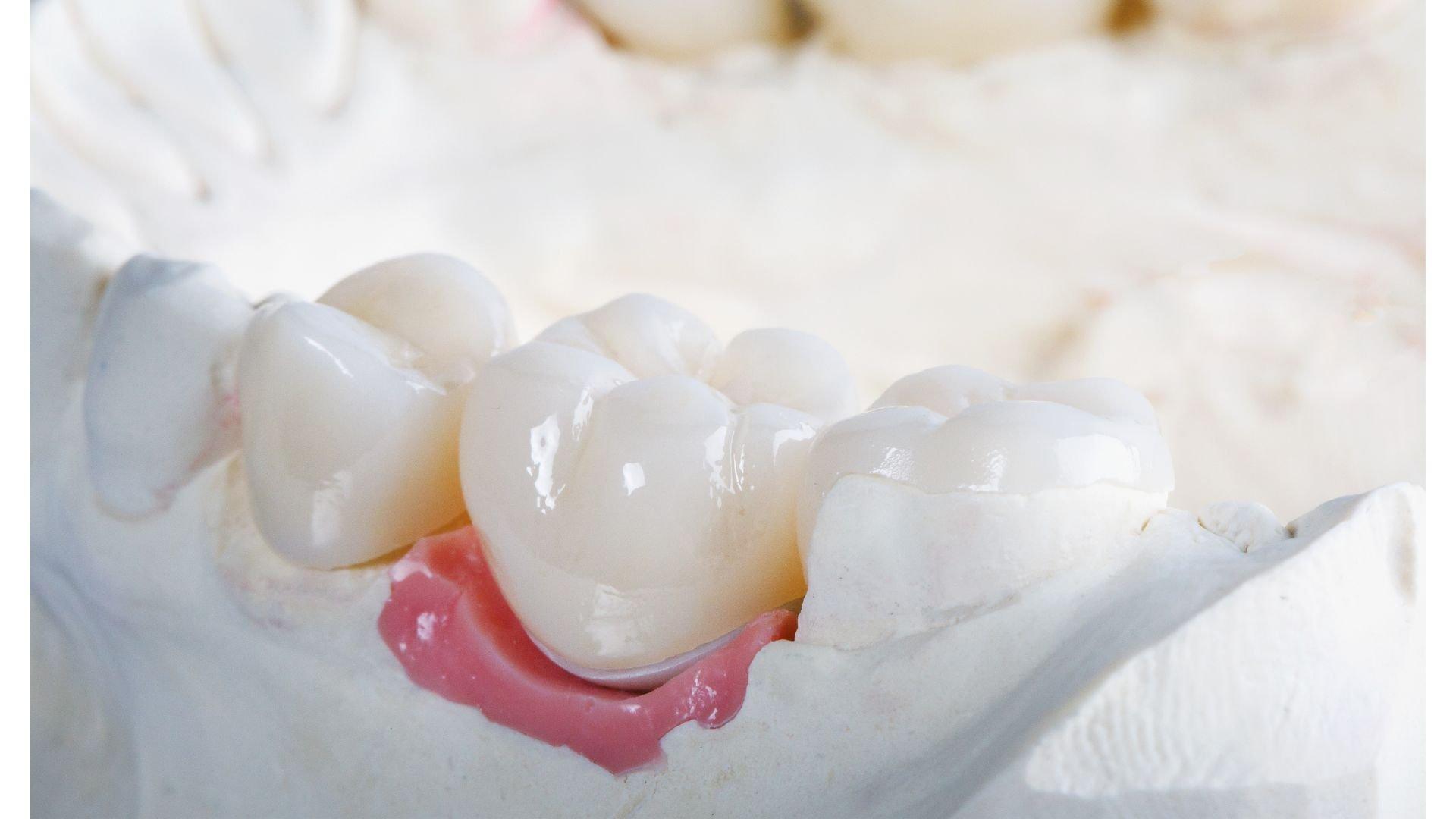 歯科矯正は本当に高い？コスパの考え方を整理