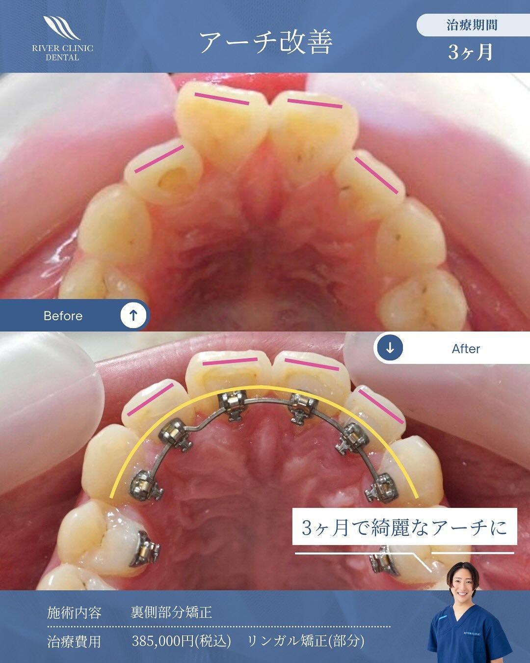治療期間と通院回数が費用に与える影響