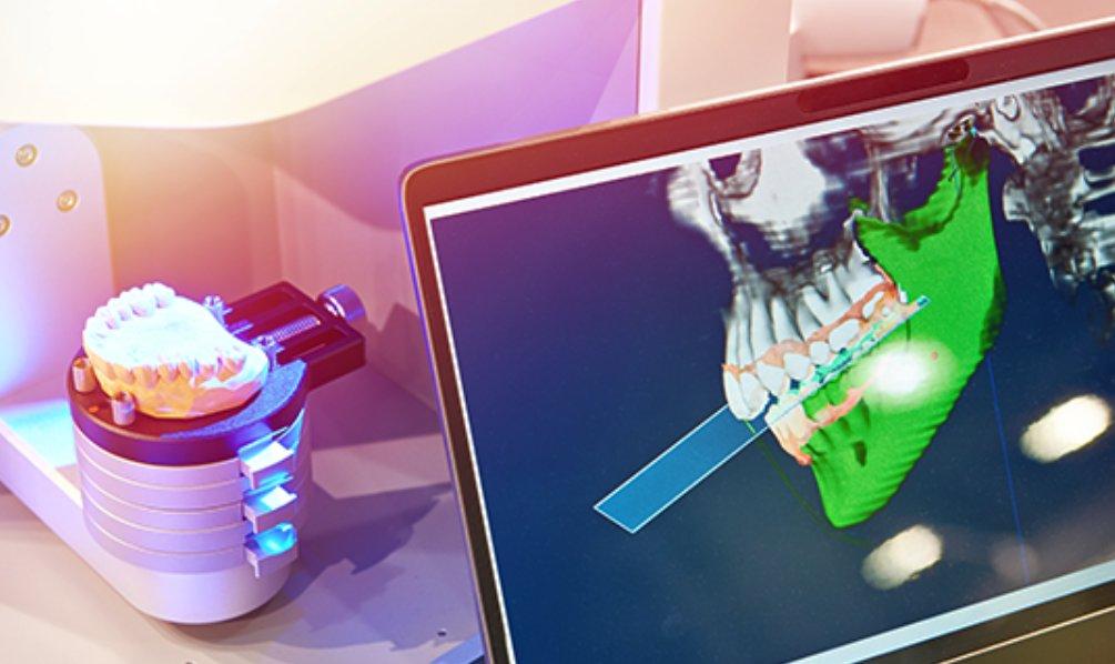 海外矯正や通販型矯正の費用とリスク